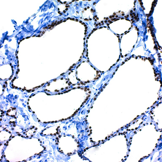 CRF Anti-Polyvalent HRP Polymer (DAB) Stain Kit